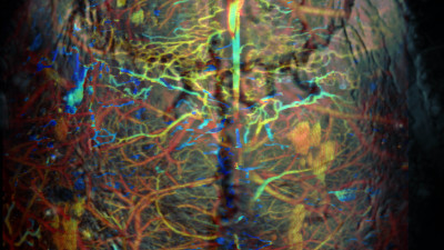 Junjie Yao: Listening into the Body through Light