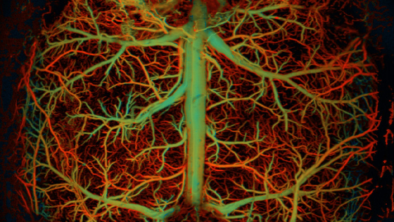 High-speed photoacoustic microscopy of the brain functions